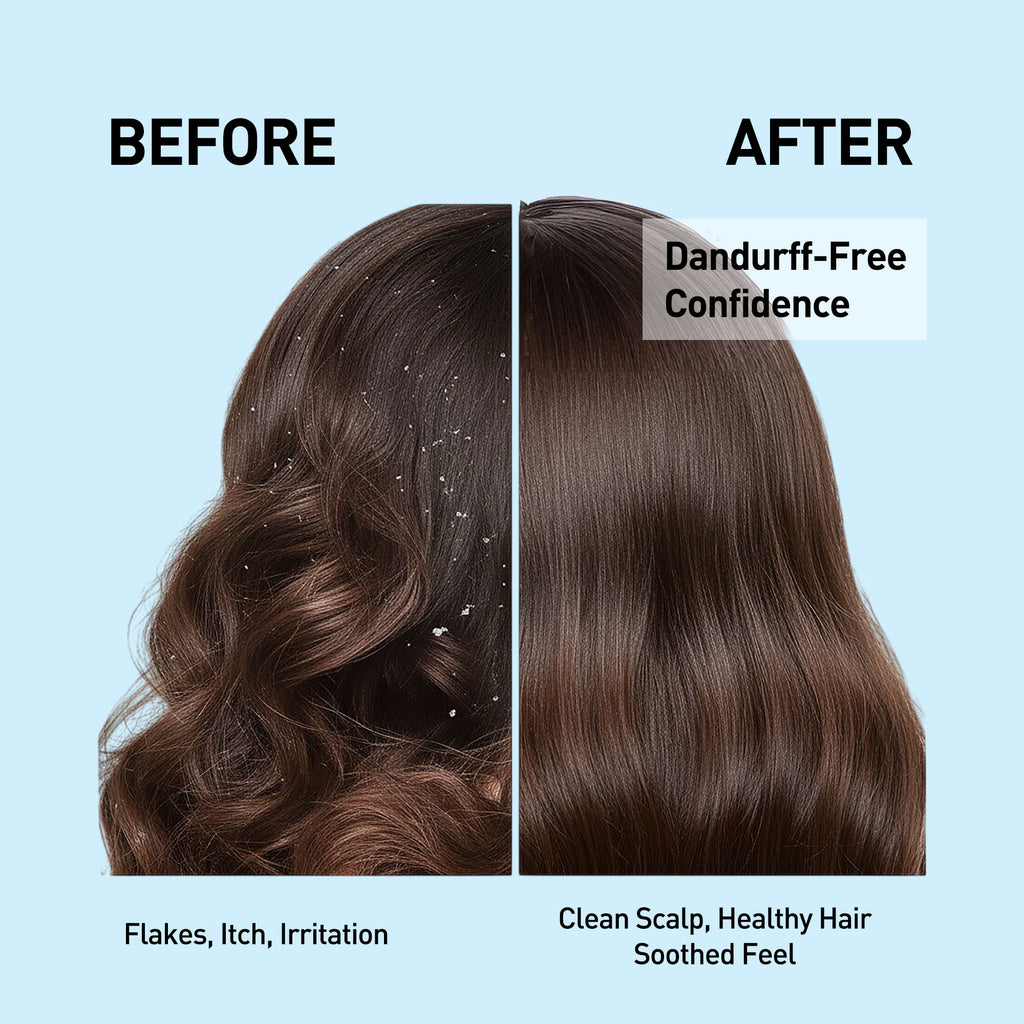 Anti Dandruff Shampoo
