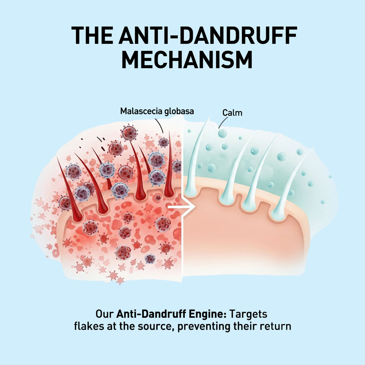 Diagram of the anti-dandruff mechanism with text on a light blue background.