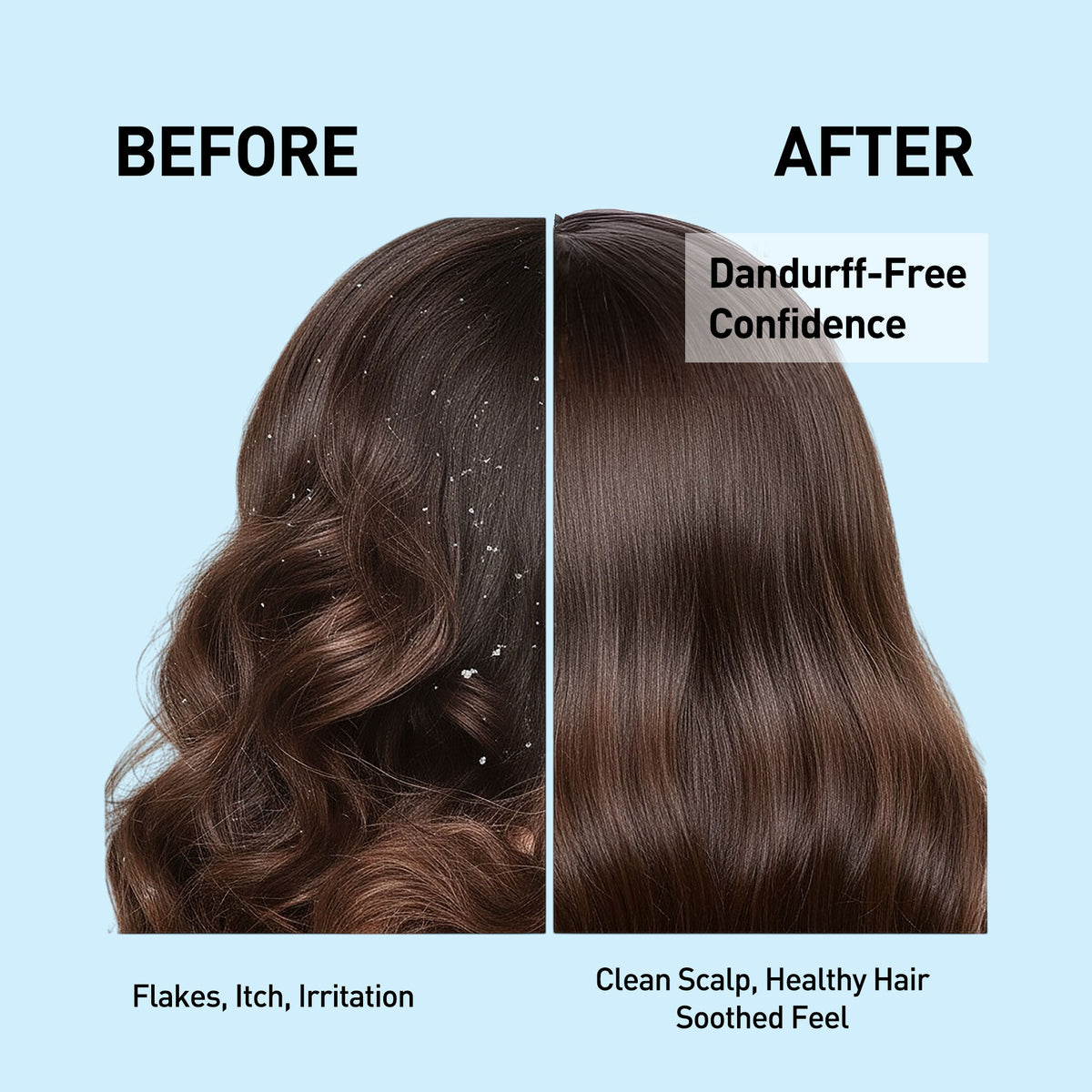 Before and after comparison of hair with dandruff on a blue background