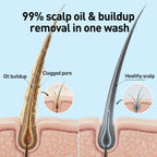 Illustration of a scalp with oil buildup, a clogged pore, and a healthy scalp, showing 99% scalp oil and buildup removal in one wash.