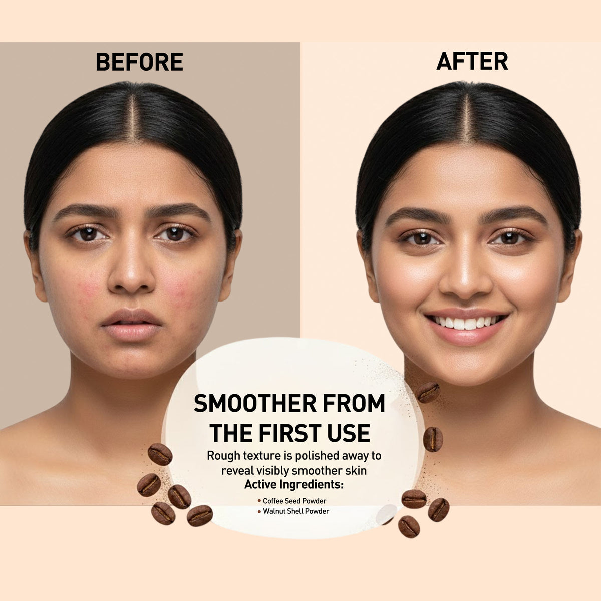 Before and after comparison of a woman's face with text about a smoother skin product.