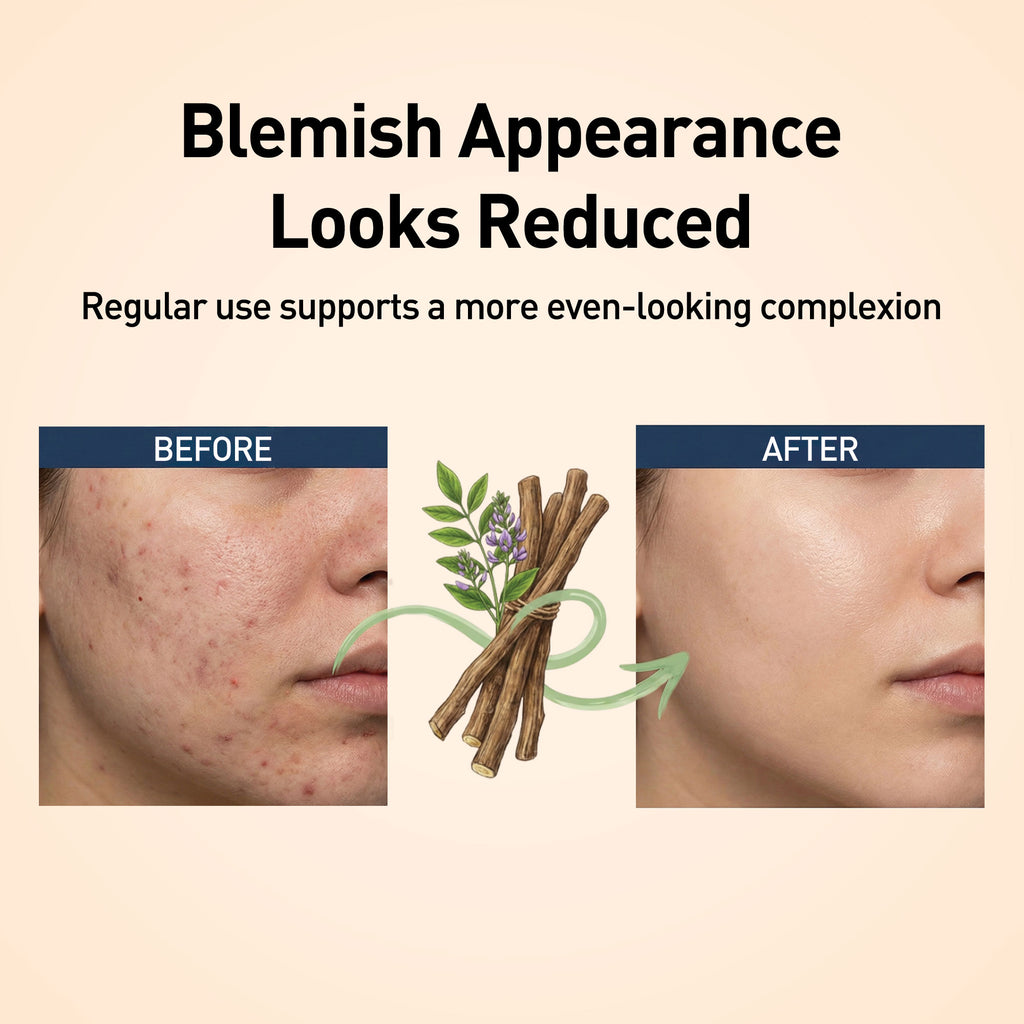Before and after comparison of skin with blemishes, showing reduced appearance with regular use, on a beige background.