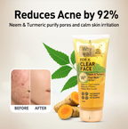 Teenage Acne Kit