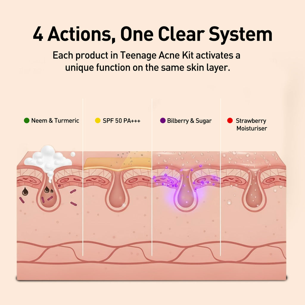 Teenage Acne Kit