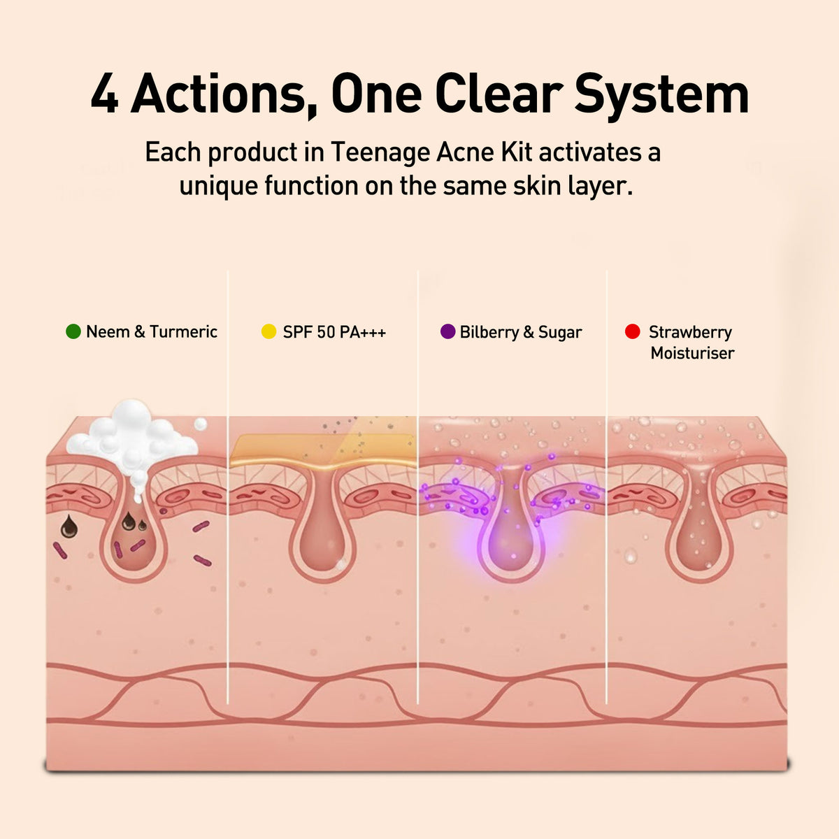 Teenage Acne Kit