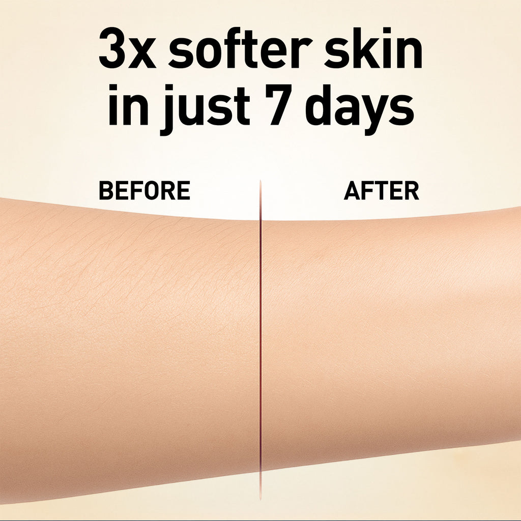 Before and after comparison of skin texture with text '3x softer skin in just 7 days' on a beige background.