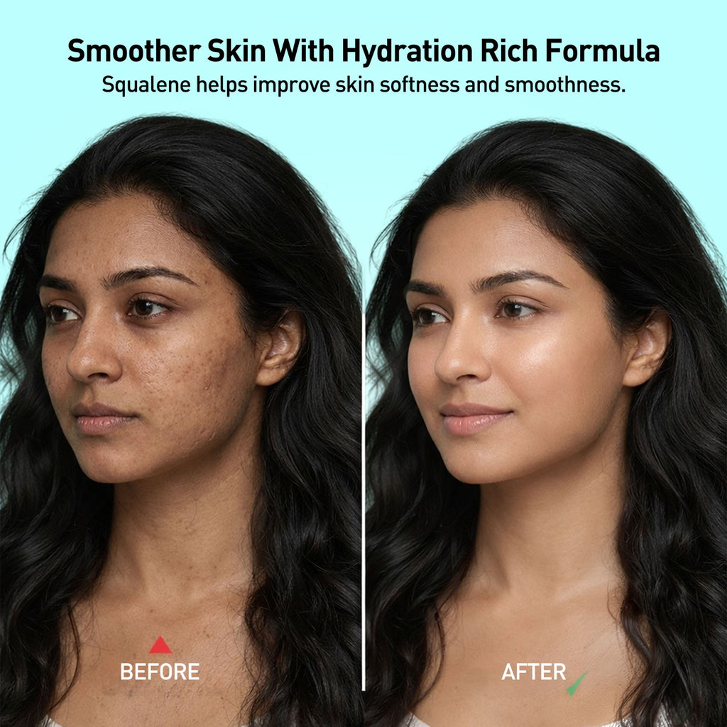 W2 Rice Water Day Hydra Gel- 80g
