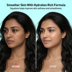W2 Rice Water Day Hydra Gel- 80g