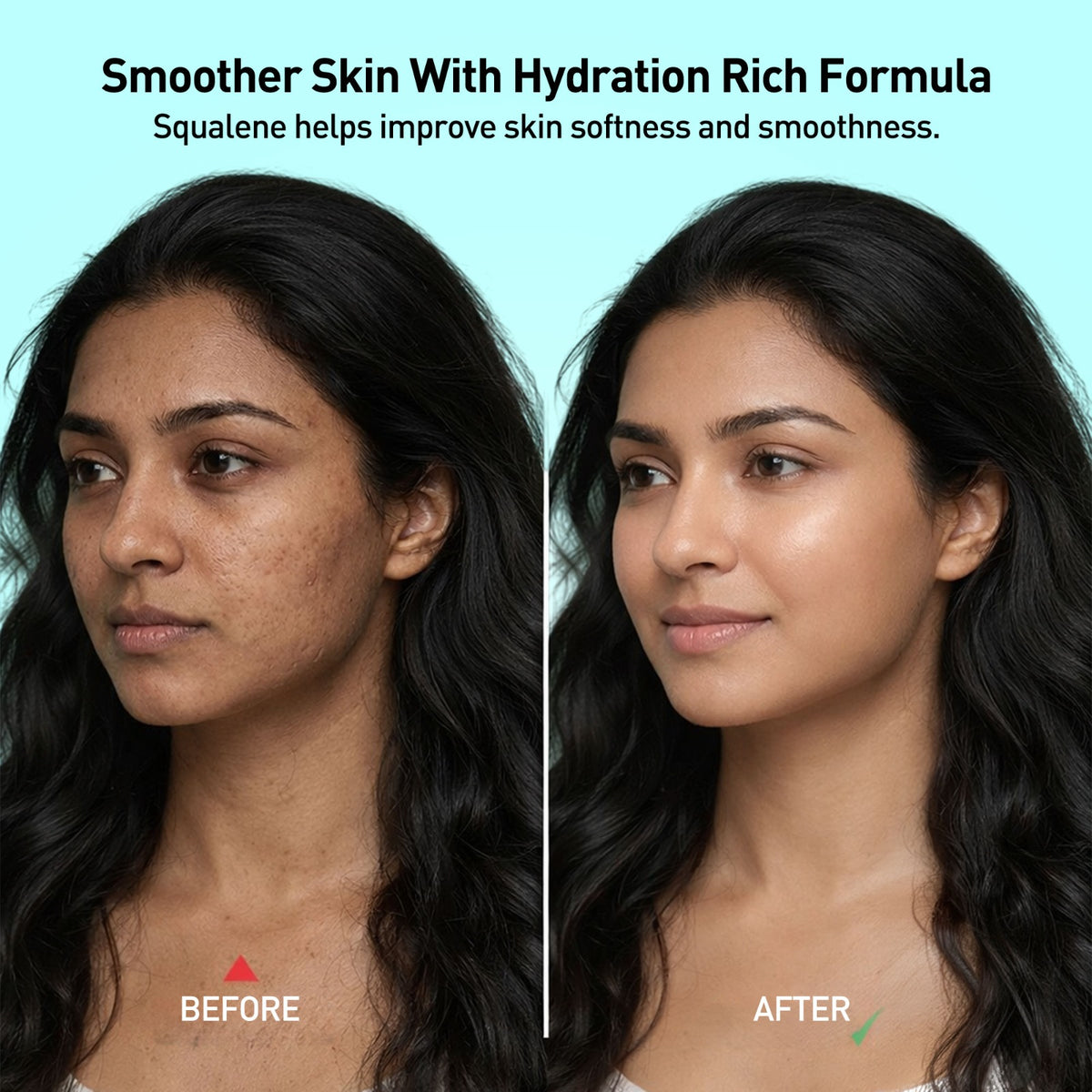 W2 Rice Water Day Hydra Gel- 80g