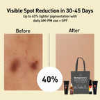 Bangalore Pigmentation Kit